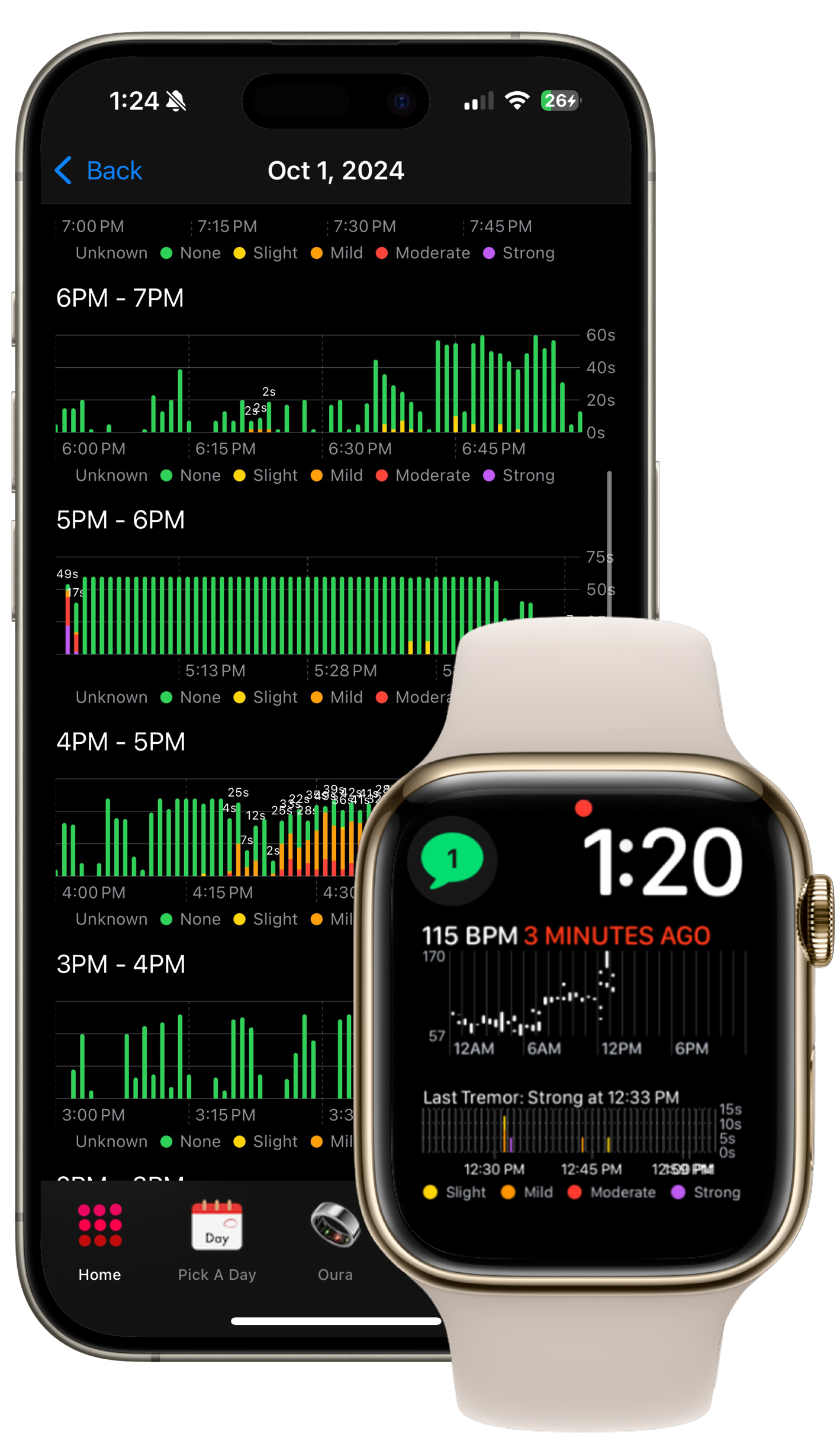 iPhone 15 Pro (blue titanium) and Apple Watch Series 8 (gold) showing tremor strength data in each device-specific HeartCloud Sync app